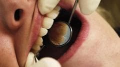 Patients Urged to Get Tested After Dentist's Unsafe Practices Exposed